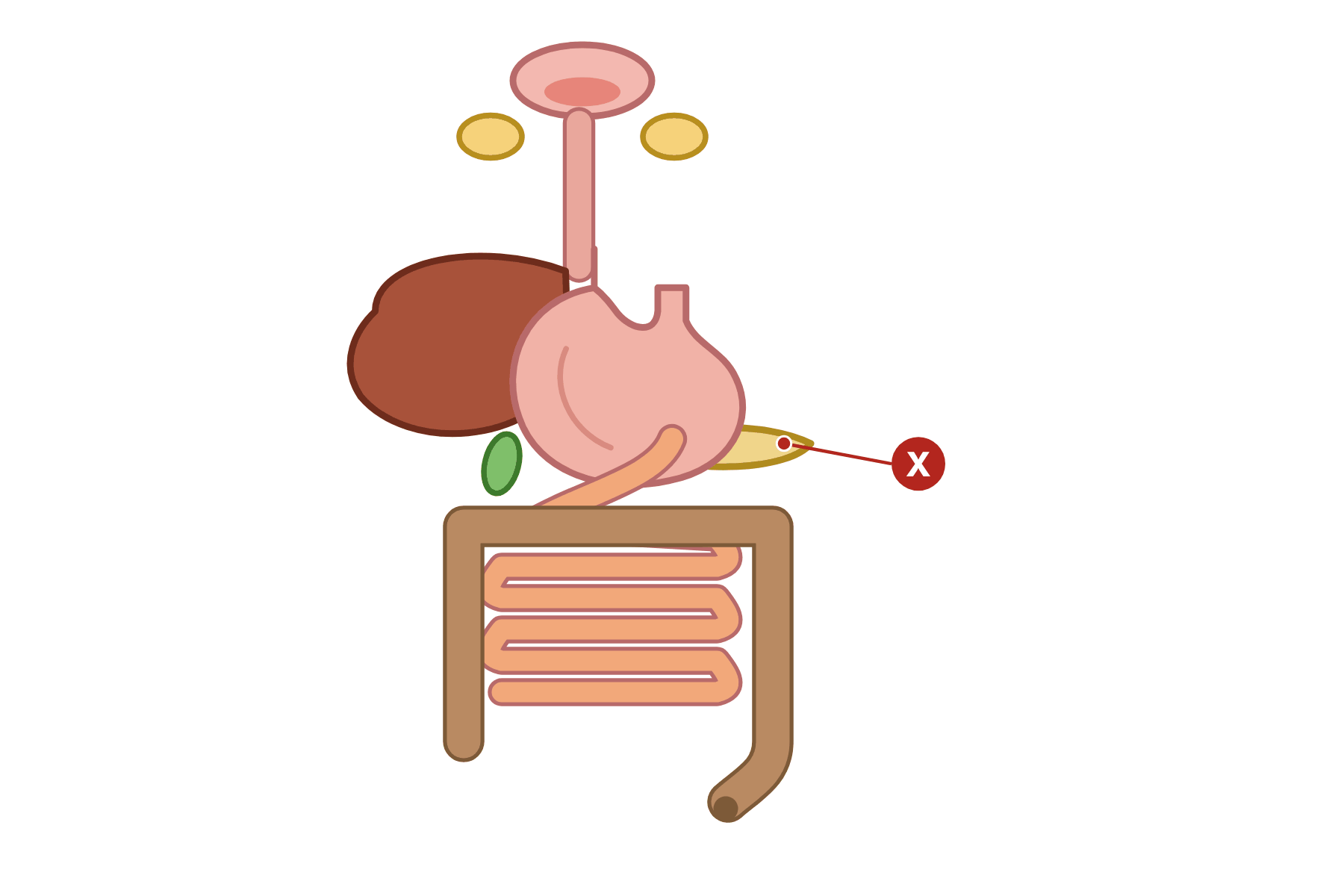A diagram of the digestive system with a marker X on the pancreas.